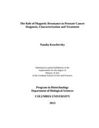 thumnail for Kruchevsky-thesis05072013_nk.docx