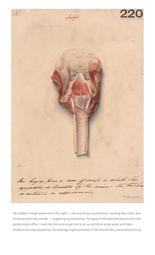 thumnail for https:_medicalhealthhumanities_com_2022_09_15_echoing_women_from_sarah_partons_ruth_hall_croup_cough_and_sound_intuition_in_the_19c_and_today_11_7_2023_6_05_55_AM.pdf